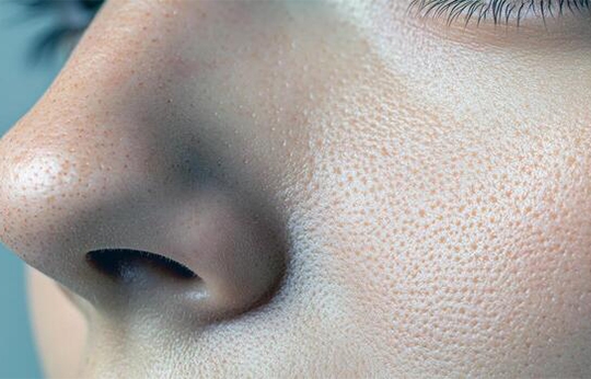 چرا منافذ پوست بزرگ می شوند؟